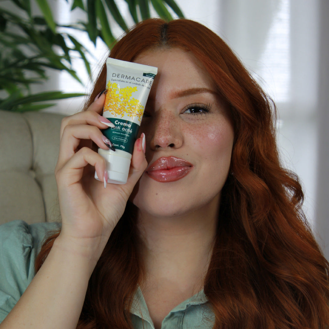 Combate el Acné con el Poder Natural de la Crema de Mimosa Tenuiflora